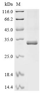 (Tris-Glycine gel) Discontinuous SDS-PAGE (reduced) with 5% enrichment gel and 15% separation gel. (Tris-Glycine gel) Discontinuous SDS-PAGE (reduced) with 5% enrichment gel and 15% separation gel.