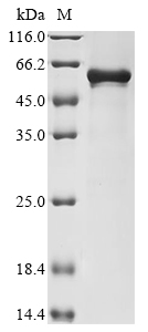 Recombinant Human Calcium-binding and coiled-coil domain-containing protein 2 (CALCOCO2) - image 1