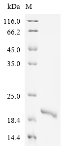 Recombinant Human Interleukin-18 (IL18) - image 1