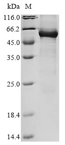 (Tris-Glycine gel) Discontinuous SDS-PAGE (reduced) with 5% enrichment gel and 15% separation gel. (Tris-Glycine gel) Discontinuous SDS-PAGE (reduced) with 5% enrichment gel and 15% separation gel.
