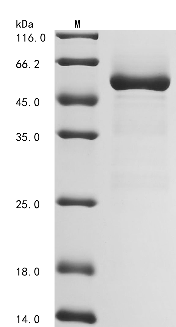 (Tris-Glycine gel) Discontinuous SDS-PAGE (reduced) with 5% enrichment gel and 15% separation gel. (Tris-Glycine gel) Discontinuous SDS-PAGE (reduced) with 5% enrichment gel and 15% separation gel.