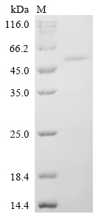 Recombinant Human Neuronal pentraXIn-1 (NPTX1) , partial - image 1
