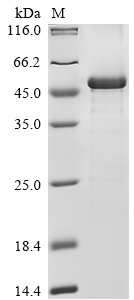 (Tris-Glycine gel) Discontinuous SDS-PAGE (reduced) with 5% enrichment gel and 15% separation gel. (Tris-Glycine gel) Discontinuous SDS-PAGE (reduced) with 5% enrichment gel and 15% separation gel.