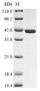 (Tris-Glycine gel) Discontinuous SDS-PAGE (reduced) with 5% enrichment gel and 15% separation gel. (Tris-Glycine gel) Discontinuous SDS-PAGE (reduced) with 5% enrichment gel and 15% separation gel.