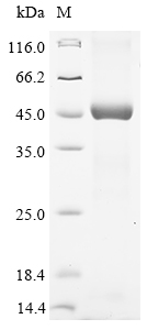 (Tris-Glycine gel) Discontinuous SDS-PAGE (reduced) with 5% enrichment gel and 15% separation gel. (Tris-Glycine gel) Discontinuous SDS-PAGE (reduced) with 5% enrichment gel and 15% separation gel.