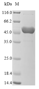 (Tris-Glycine gel) Discontinuous SDS-PAGE (reduced) with 5% enrichment gel and 15% separation gel. (Tris-Glycine gel) Discontinuous SDS-PAGE (reduced) with 5% enrichment gel and 15% separation gel.