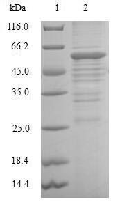 (Tris-Glycine gel) Discontinuous SDS-PAGE (reduced) with 5% enrichment gel and 15% separation gel. (Tris-Glycine gel) Discontinuous SDS-PAGE (reduced) with 5% enrichment gel and 15% separation gel.