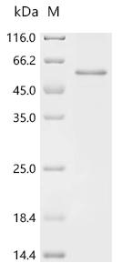 Recombinant Rat Latent transforming growth factor beta binding protein 4 (Ltbp4) , partial - image 1