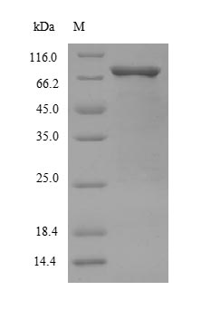 SDS-PAGE- Recombinant protein Human SMAD2