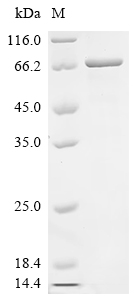 (Tris-Glycine gel) Discontinuous SDS-PAGE (reduced) with 5% enrichment gel and 15% separation gel. (Tris-Glycine gel) Discontinuous SDS-PAGE (reduced) with 5% enrichment gel and 15% separation gel.