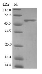 (Tris-Glycine gel) Discontinuous SDS-PAGE (reduced) with 5% enrichment gel and 15% separation gel. (Tris-Glycine gel) Discontinuous SDS-PAGE (reduced) with 5% enrichment gel and 15% separation gel.