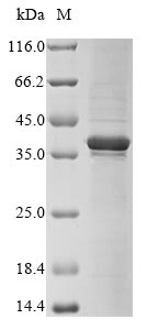 (Tris-Glycine gel) Discontinuous SDS-PAGE (reduced) with 5% enrichment gel and 15% separation gel. (Tris-Glycine gel) Discontinuous SDS-PAGE (reduced) with 5% enrichment gel and 15% separation gel.