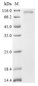 (Tris-Glycine gel) Discontinuous SDS-PAGE (reduced) with 5% enrichment gel and 15% separation gel. (Tris-Glycine gel) Discontinuous SDS-PAGE (reduced) with 5% enrichment gel and 15% separation gel.