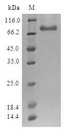 (Tris-Glycine gel) Discontinuous SDS-PAGE (reduced) with 5% enrichment gel and 15% separation gel. (Tris-Glycine gel) Discontinuous SDS-PAGE (reduced) with 5% enrichment gel and 15% separation gel.
