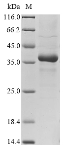 Recombinant Human Ficolin-2 (FCN2) - image 1