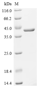 (Tris-Glycine gel) Discontinuous SDS-PAGE (reduced) with 5% enrichment gel and 15% separation gel.