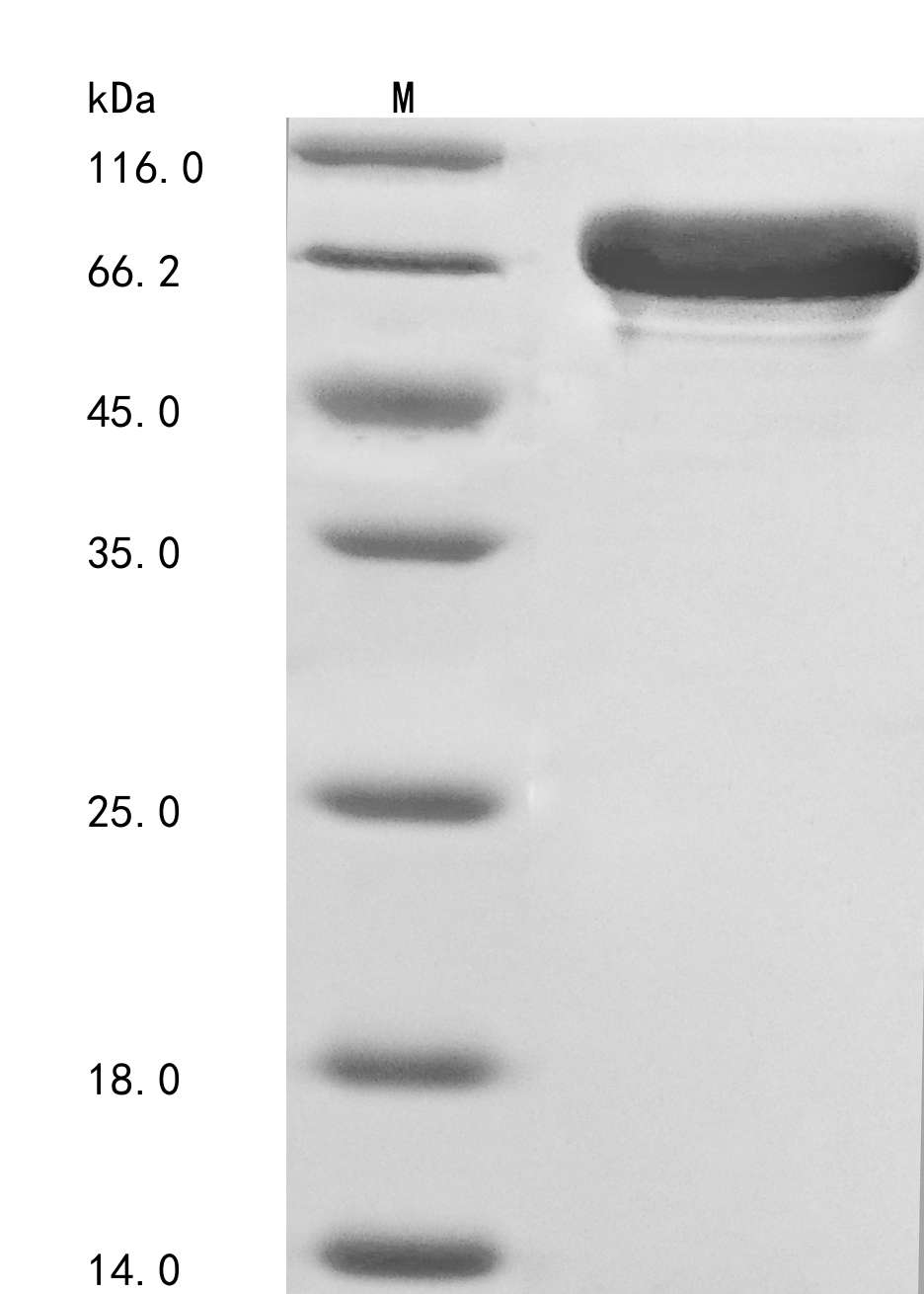 (Tris-Glycine gel) Discontinuous SDS-PAGE (reduced) with 5% enrichment gel and 15% separation gel. (Tris-Glycine gel) Discontinuous SDS-PAGE (reduced) with 5% enrichment gel and 15% separation gel.