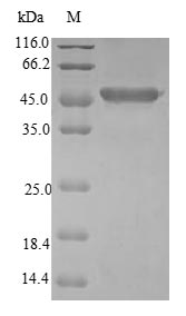 (Tris-Glycine gel) Discontinuous SDS-PAGE (reduced) with 5% enrichment gel and 15% separation gel. (Tris-Glycine gel) Discontinuous SDS-PAGE (reduced) with 5% enrichment gel and 15% separation gel.