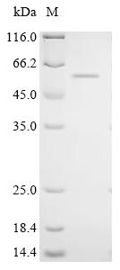 Recombinant Human Cysteine dioxygenase type 1 (CDO1) - image 1