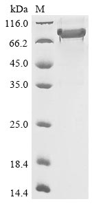 Recombinant Human Semaphorin-3B (SEMA3B) - image 1