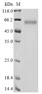 (Tris-Glycine gel) Discontinuous SDS-PAGE (reduced) with 5% enrichment gel and 15% separation gel. (Tris-Glycine gel) Discontinuous SDS-PAGE (reduced) with 5% enrichment gel and 15% separation gel.