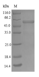 (Tris-Glycine gel) Discontinuous SDS-PAGE (reduced) with 5% enrichment gel and 15% separation gel. (Tris-Glycine gel) Discontinuous SDS-PAGE (reduced) with 5% enrichment gel and 15% separation gel.