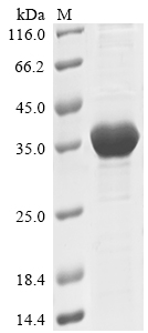 (Tris-Glycine gel) Discontinuous SDS-PAGE (reduced) with 5% enrichment gel and 15% separation gel. (Tris-Glycine gel) Discontinuous SDS-PAGE (reduced) with 5% enrichment gel and 15% separation gel.