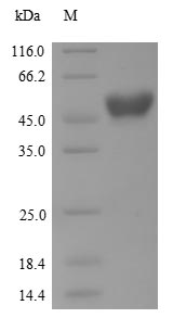SDS-PAGE- Recombinant protein Human AANAT