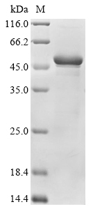 (Tris-Glycine gel) Discontinuous SDS-PAGE (reduced) with 5% enrichment gel and 15% separation gel. (Tris-Glycine gel) Discontinuous SDS-PAGE (reduced) with 5% enrichment gel and 15% separation gel.