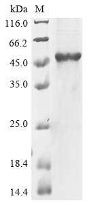Recombinant Human Putative pregnancy-specific beta-1-glycoprotein 7 (PSG7) - image 1
