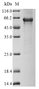 Recombinant Human G/T mismatch-specific thymine DNA glycosylase (TDG) - image 1
