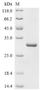 Recombinant Human G/T mismatch-specific thymine DNA glycosylase (TDG) , partial - image 1