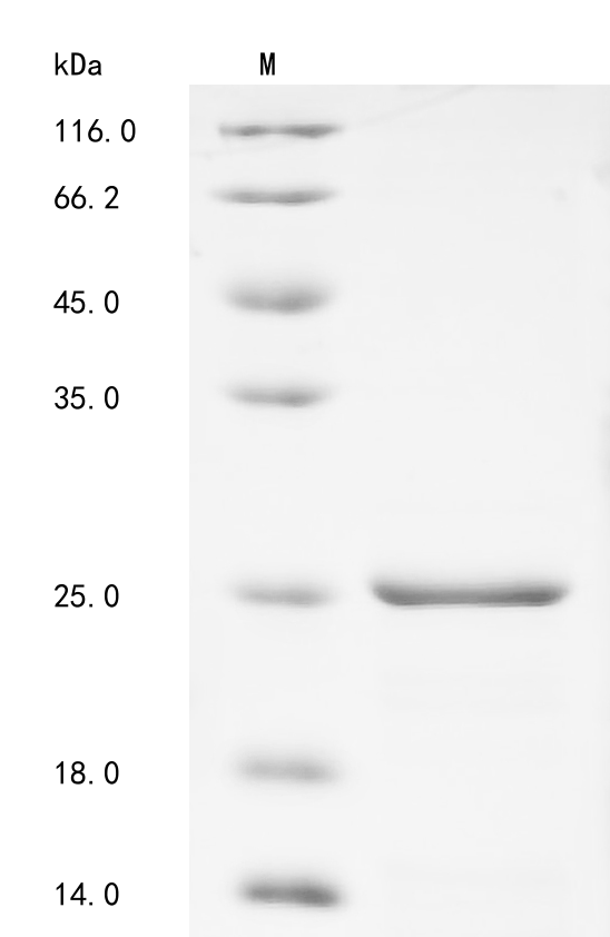 Recombinant Human Beta-synuclein (SNCB) - image 1