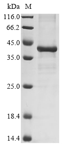 (Tris-Glycine gel) Discontinuous SDS-PAGE (reduced) with 5% enrichment gel and 15% separation gel. (Tris-Glycine gel) Discontinuous SDS-PAGE (reduced) with 5% enrichment gel and 15% separation gel.