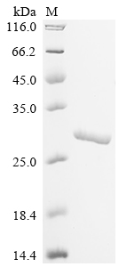(Tris-Glycine gel) Discontinuous SDS-PAGE (reduced) with 5% enrichment gel and 15% separation gel. (Tris-Glycine gel) Discontinuous SDS-PAGE (reduced) with 5% enrichment gel and 15% separation gel.
