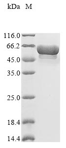 (Tris-Glycine gel) Discontinuous SDS-PAGE (reduced) with 5% enrichment gel and 15% separation gel. (Tris-Glycine gel) Discontinuous SDS-PAGE (reduced) with 5% enrichment gel and 15% separation gel.