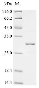 Recombinant Epstein-Barr virus Epstein-Barr nuclear antigen 1 (EBNA1) , partial - image 1