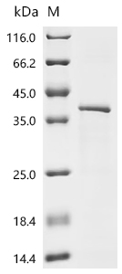 (Tris-Glycine gel) Discontinuous SDS-PAGE (reduced) with 5% enrichment gel and 15% separation gel.