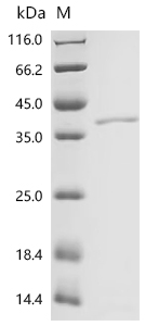 (Tris-Glycine gel) Discontinuous SDS-PAGE (reduced) with 5% enrichment gel and 15% separation gel.