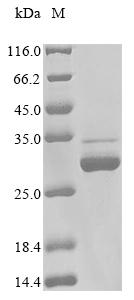 (Tris-Glycine gel) Discontinuous SDS-PAGE (reduced) with 5% enrichment gel and 15% separation gel. (Tris-Glycine gel) Discontinuous SDS-PAGE (reduced) with 5% enrichment gel and 15% separation gel.