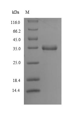 (Tris-Glycine gel) Discontinuous SDS-PAGE (reduced) with 5% enrichment gel and 15% separation gel.