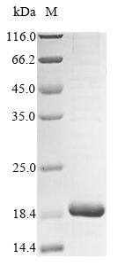 (Tris-Glycine gel) Discontinuous SDS-PAGE (reduced) with 5% enrichment gel and 15% separation gel. (Tris-Glycine gel) Discontinuous SDS-PAGE (reduced) with 5% enrichment gel and 15% separation gel.