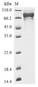 (Tris-Glycine gel) Discontinuous SDS-PAGE (reduced) with 5% enrichment gel and 15% separation gel. (Tris-Glycine gel) Discontinuous SDS-PAGE (reduced) with 5% enrichment gel and 15% separation gel.