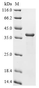 Recombinant Rabbit Methylosome subunit pICln (CLNS1A) - image 1