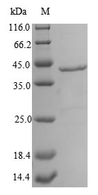 (Tris-Glycine gel) Discontinuous SDS-PAGE (reduced) with 5% enrichment gel and 15% separation gel.