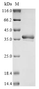 (Tris-Glycine gel) Discontinuous SDS-PAGE (reduced) with 5% enrichment gel and 15% separation gel.
