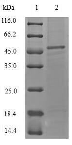 (Tris-Glycine gel) Discontinuous SDS-PAGE (reduced) with 5% enrichment gel and 15% separation gel. (Tris-Glycine gel) Discontinuous SDS-PAGE (reduced) with 5% enrichment gel and 15% separation gel.