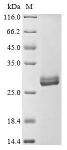 (Tris-Glycine gel) Discontinuous SDS-PAGE (reduced) with 5% enrichment gel and 15% separation gel. (Tris-Glycine gel) Discontinuous SDS-PAGE (reduced) with 5% enrichment gel and 15% separation gel.