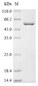 (Tris-Glycine gel) Discontinuous SDS-PAGE (reduced) with 5% enrichment gel and 15% separation gel. (Tris-Glycine gel) Discontinuous SDS-PAGE (reduced) with 5% enrichment gel and 15% separation gel.