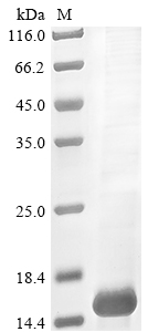 Recombinant Tityus zulianus Beta-toxin Tz1 - image 1